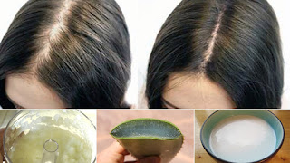 Hair Loss Best Solution